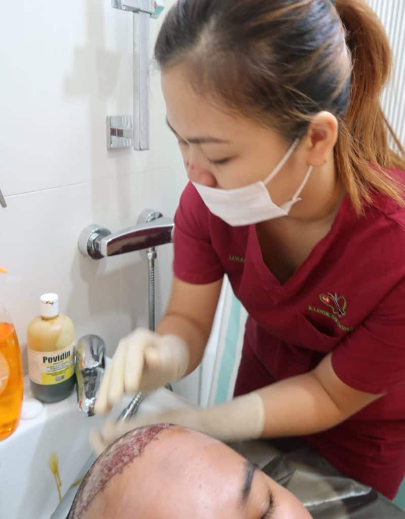 Hair Transplant Treatment