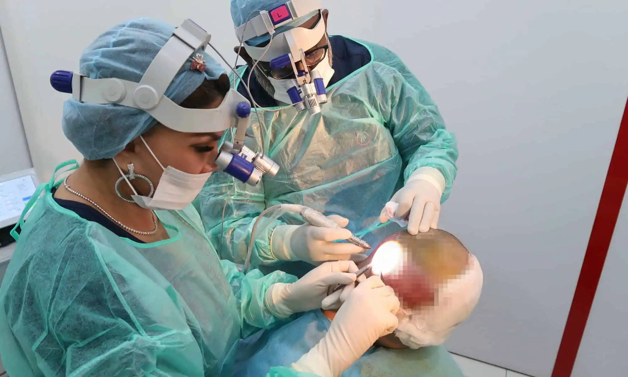 Hair Transplant Centre Malaysia Dr Inder and Dr Kula do Scar Revision At donor area FUE method