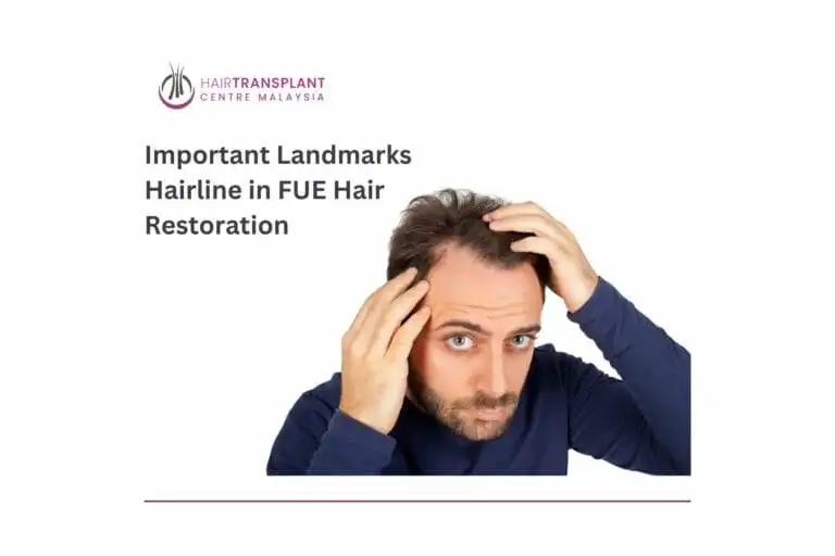 Important Landmarks Hairline in FUE Hair Restoration