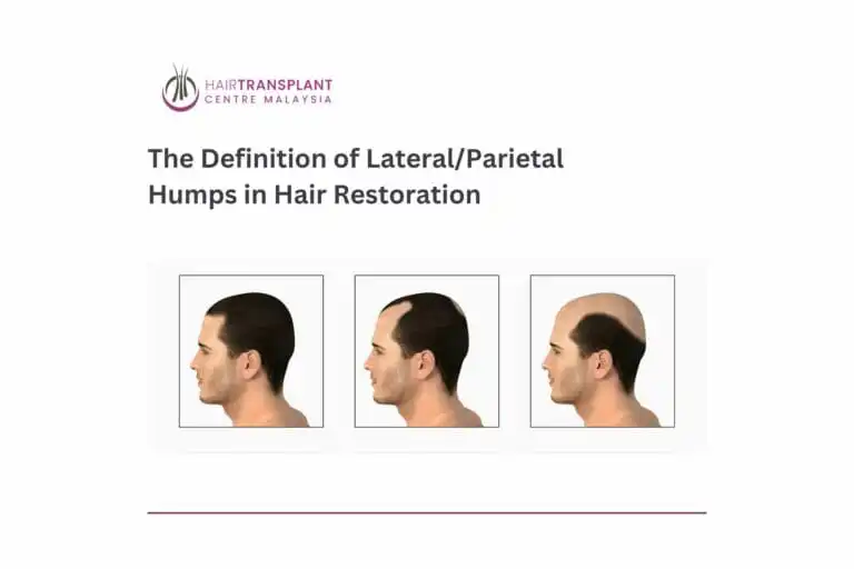 The Definition of Lateral Parietal Humps