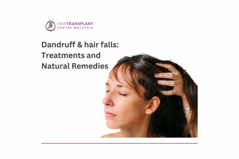 Dandruffs and hair fall