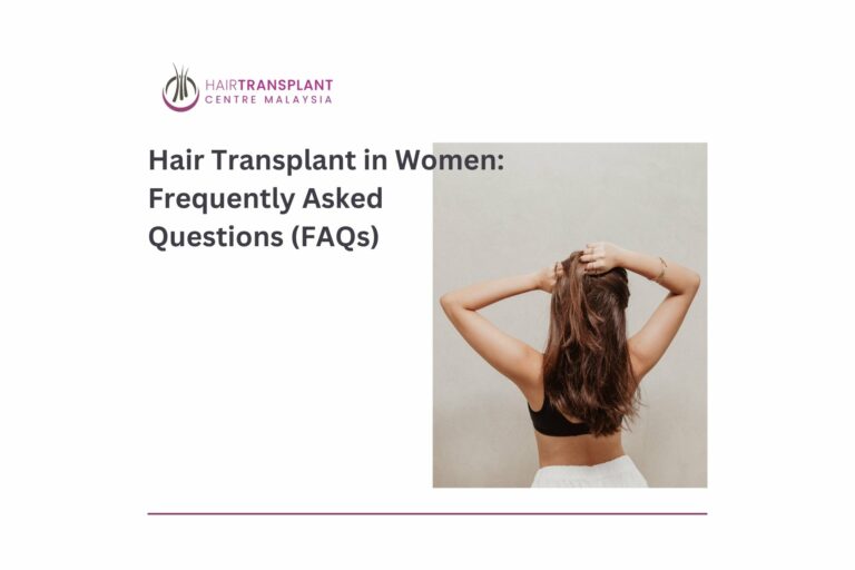 Hair transplant in women FAQs