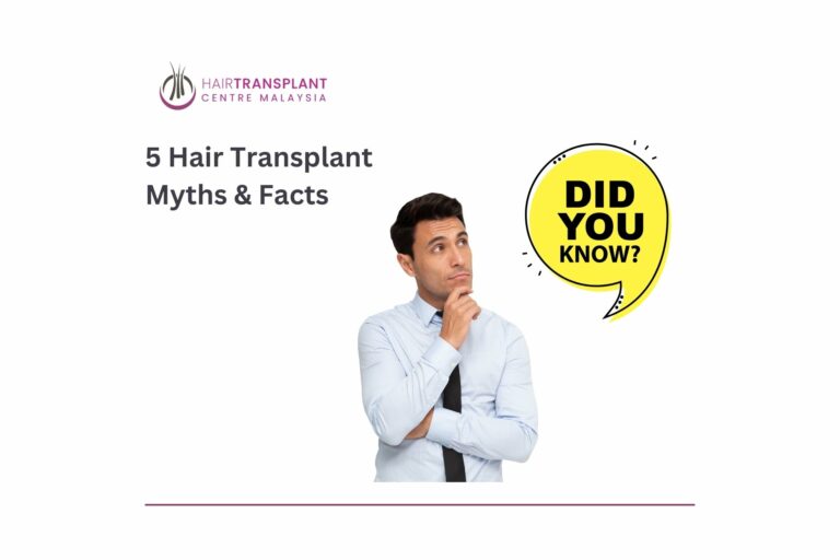 5 hair transplant and myths