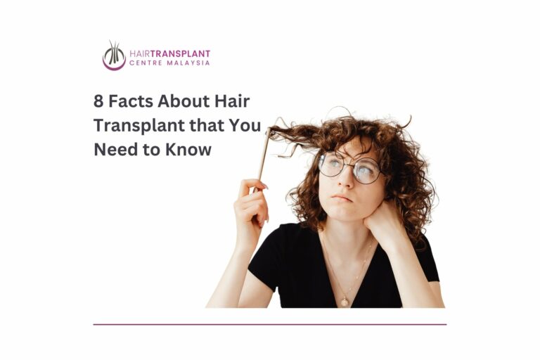 8 facts about hair transplant