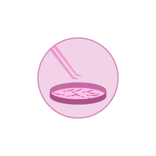 Removing and Preparing the Hair Follicles