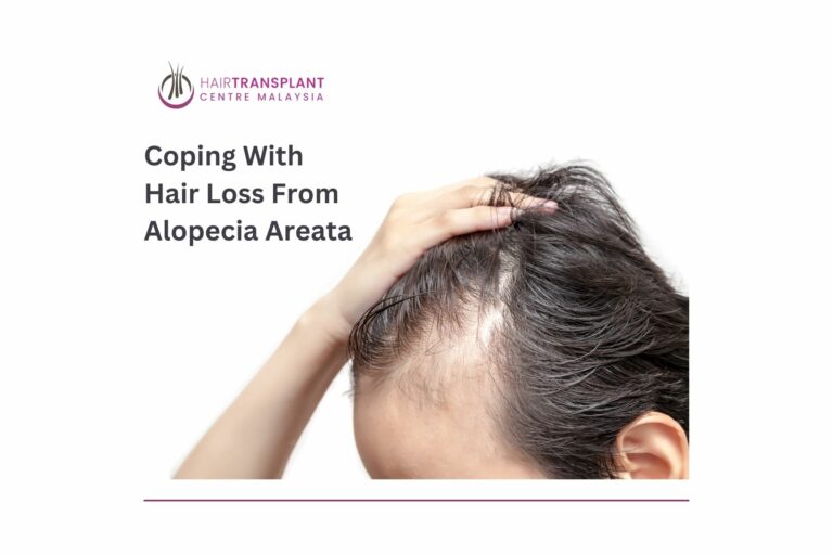 Coping With Hair Loss From Alopecia Areata