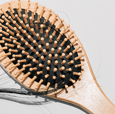 Transgender Hair Transplant