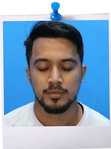 FUE Hair Transplant Malaysia