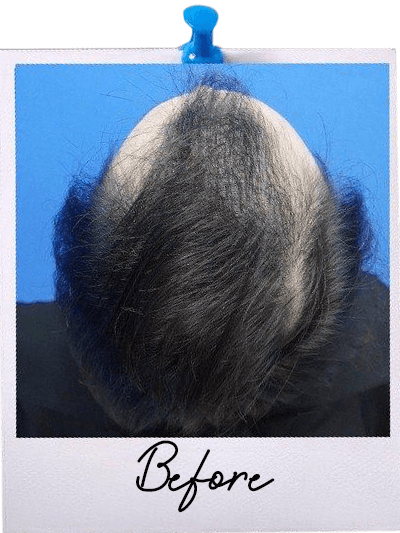 HT After Image 1