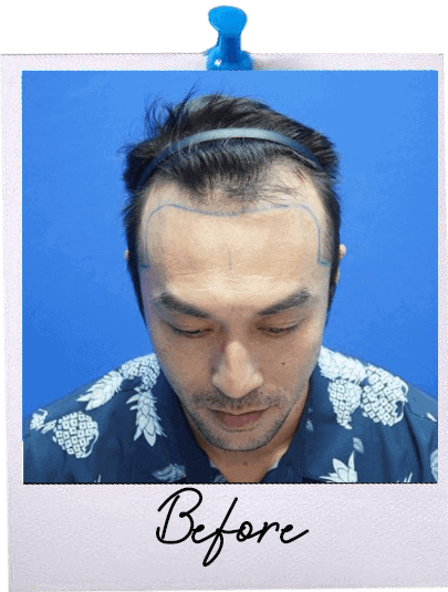 HT Before Image 123