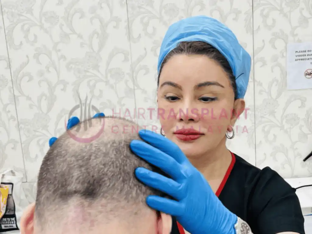Hair Transplant Centre malaysia - 1 Week after Hair Transplant: Things to Know
