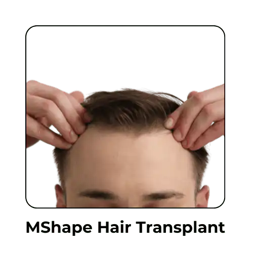 MShape Hair Transplant in Malaysia