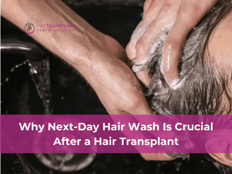 Why Next-Day Hair Wash Is Crucial After a Hair Transplant