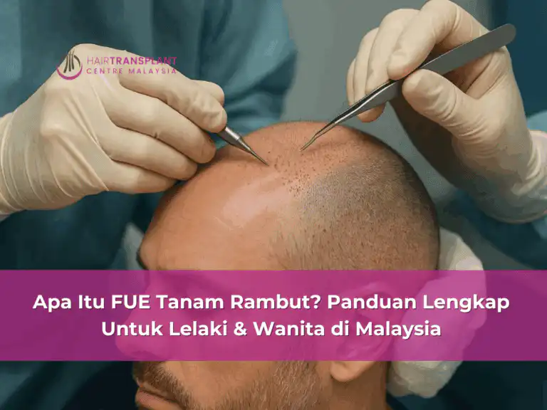 Apa Itu FUE Tanam Rambut? Panduan Lengkap Untuk Lelaki & Wanita di Malaysia