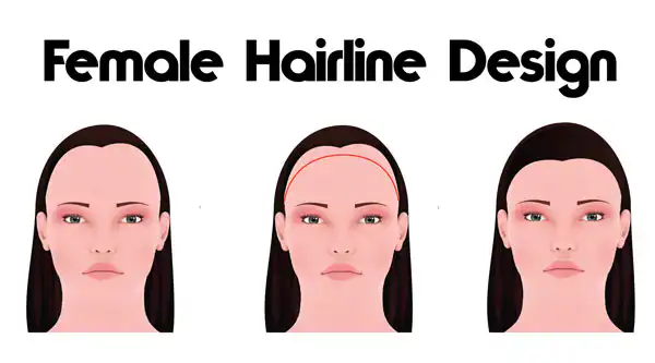 hair Transplant For Woman