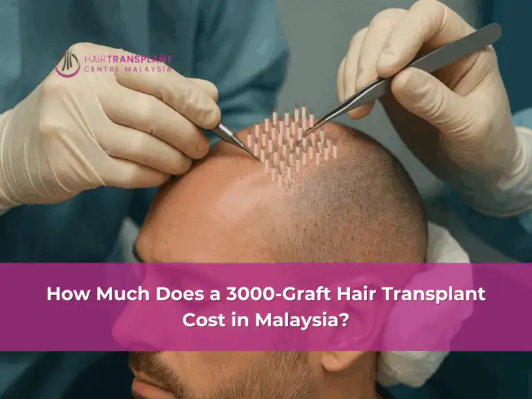 How Much Does a 3000 Graft Hair Transplant Cost in Malaysia
