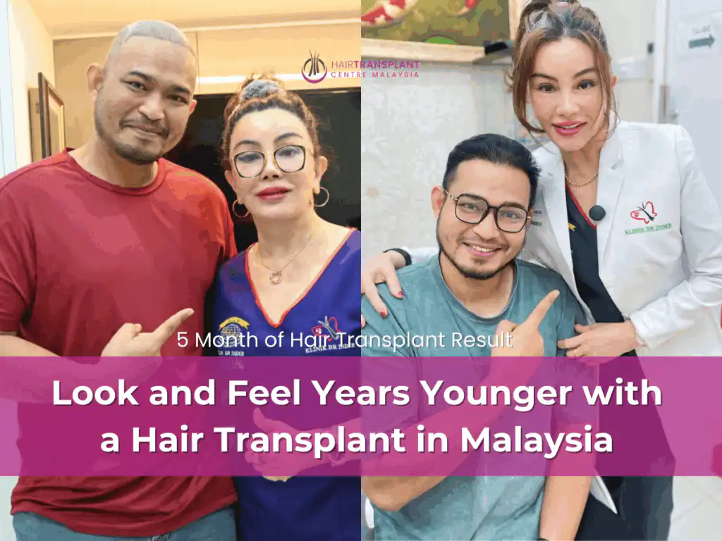 Look and Feel Years Younger with a Hair Transplant in Malaysia (1)