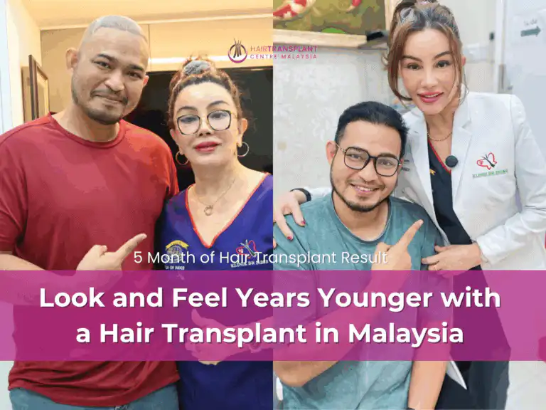 Look and Feel Years Younger with a Hair Transplant in Malaysia (1)