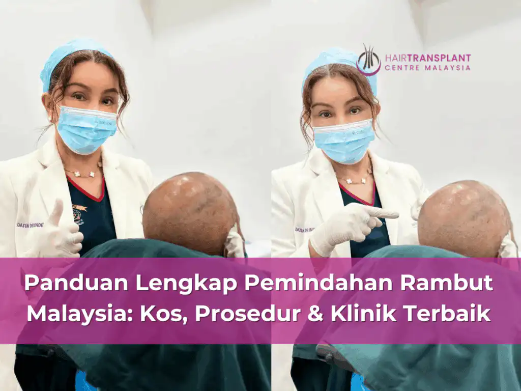 Panduan Lengkap Pemindahan Rambut Malaysia: Kos, Prosedur & Klinik Terbaik