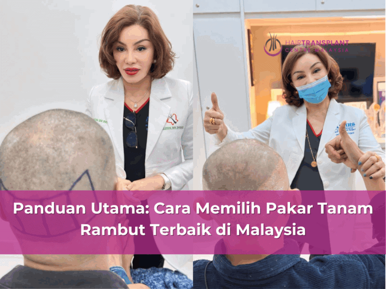 Panduan Utama Cara Memilih Pakar Tanam Rambut Terbaik di Malaysia