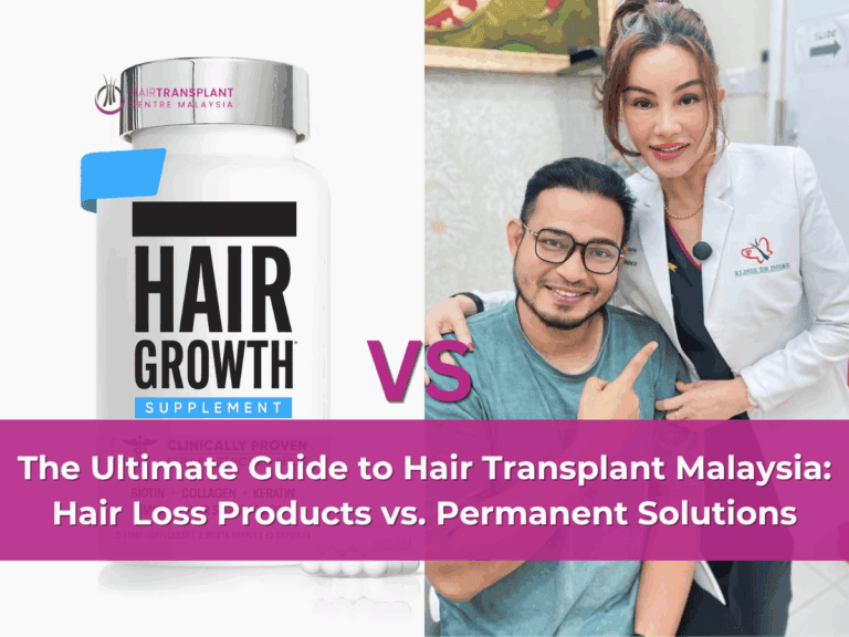 The Ultimate Guide to Hair Transplant Malaysia Hair Loss Products vs. Permanent Solutions