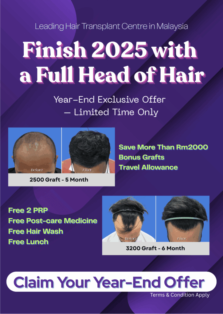 Finish 2025 with a Full Head of Hair (1)