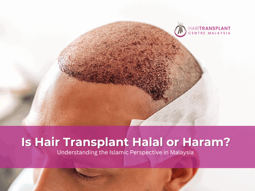 Is Hair Transplant Halal or Haram