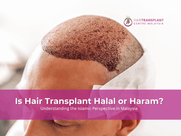 Is Hair Transplant Halal or Haram
