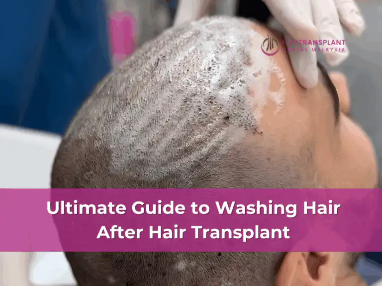 Ultimate Guide to Washing Hair After Hair Transplant