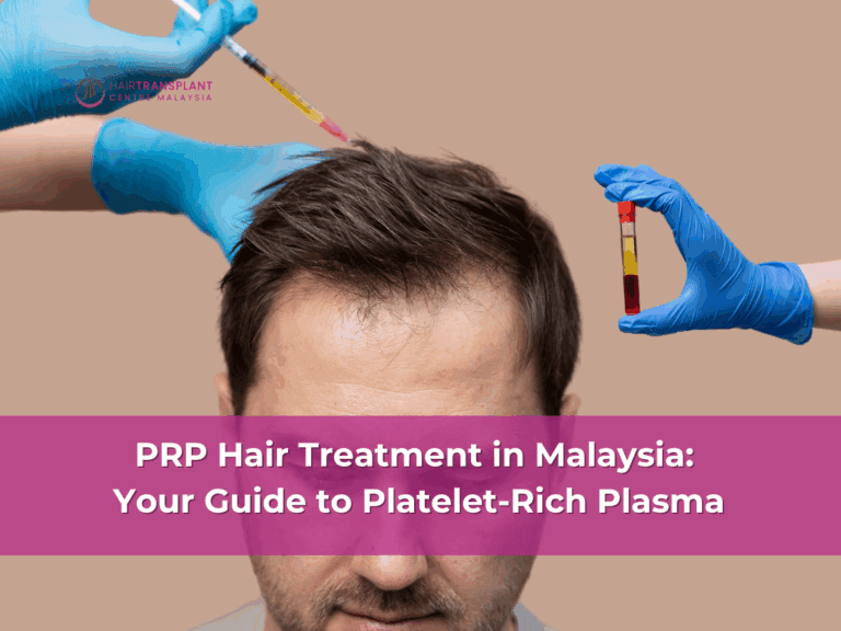 PRP For Hair Loss Treatment in Malaysia Your Guide to Platelet-Rich Plasma